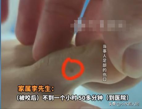 九游娱乐平台：女子疑蛇咬身亡后续！伤口曝光治疗过程耽误卫健委：封档彻查(图4)