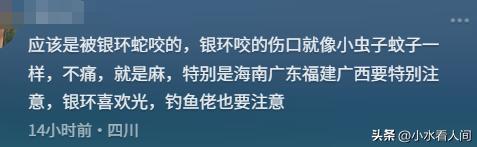 九游娱乐平台：女子疑蛇咬身亡后续！伤口曝光治疗过程耽误卫健委：封档彻查(图9)